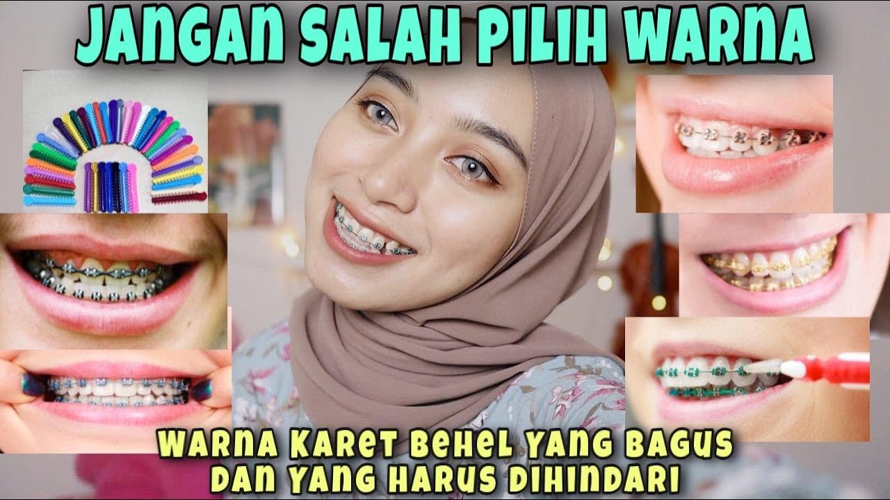 Lagi Bingung Pilih Warna Karet Behel? Ini Rekomendasi Terbaik Biar Senyum Makin On Point!