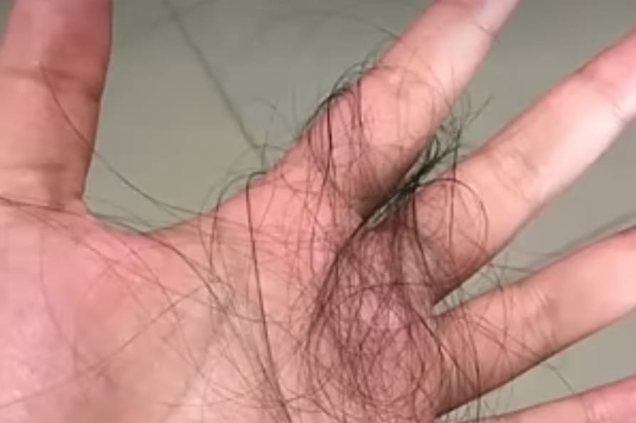 Jaga Rambut Tetap Sehat dan Indah, Ini Penyebab dan Cara Mengatasi Rambut Rontok
