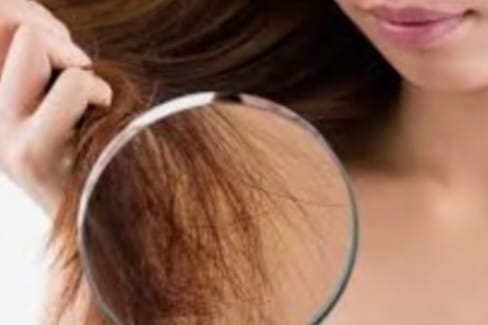 Rambut Bercabang Mengganggu Penampilan? Simak Solusi dan Cara Mencegahnya