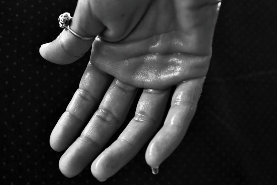 Tangan Mudah Berkeringat Bukan Tanda Penyakit Jantung? Ini Penyebab dan Cara Mengatasi Hiperhidrosis